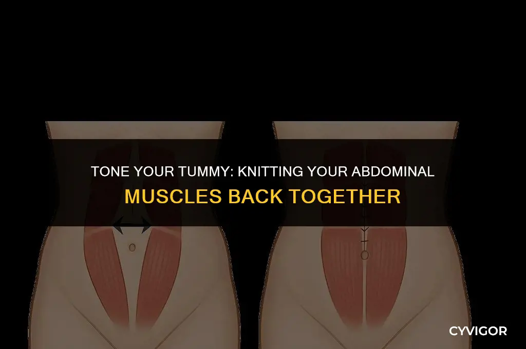 how to knit your abdomen muscles back together