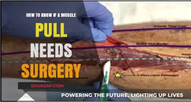 Muscle Pull Surgery: When to Consider It and Recovery Tips