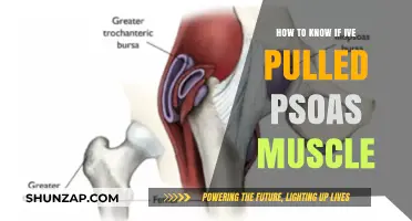 Pulled Psoas Muscle: Symptoms, Diagnosis, and Recovery Tips