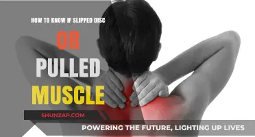 Slipped Disc or Pulled Muscle: Identifying Your Back Pain Cause