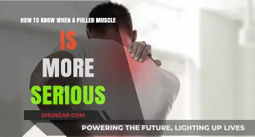 Pulled Muscle or Something Worse? Recognizing Serious Symptoms