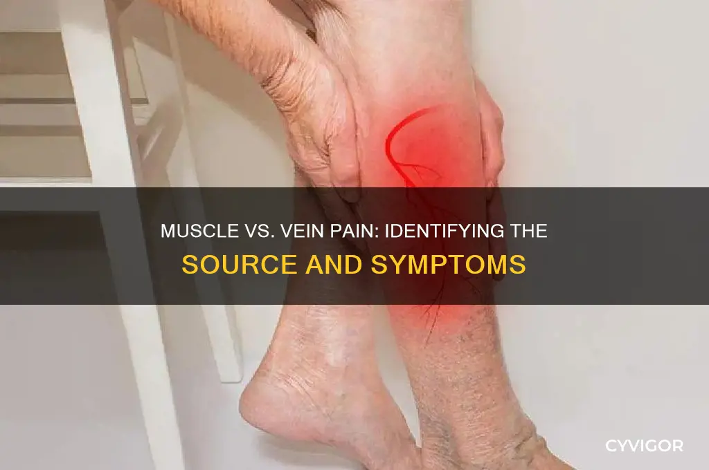 how to know when is muscle or vein pain