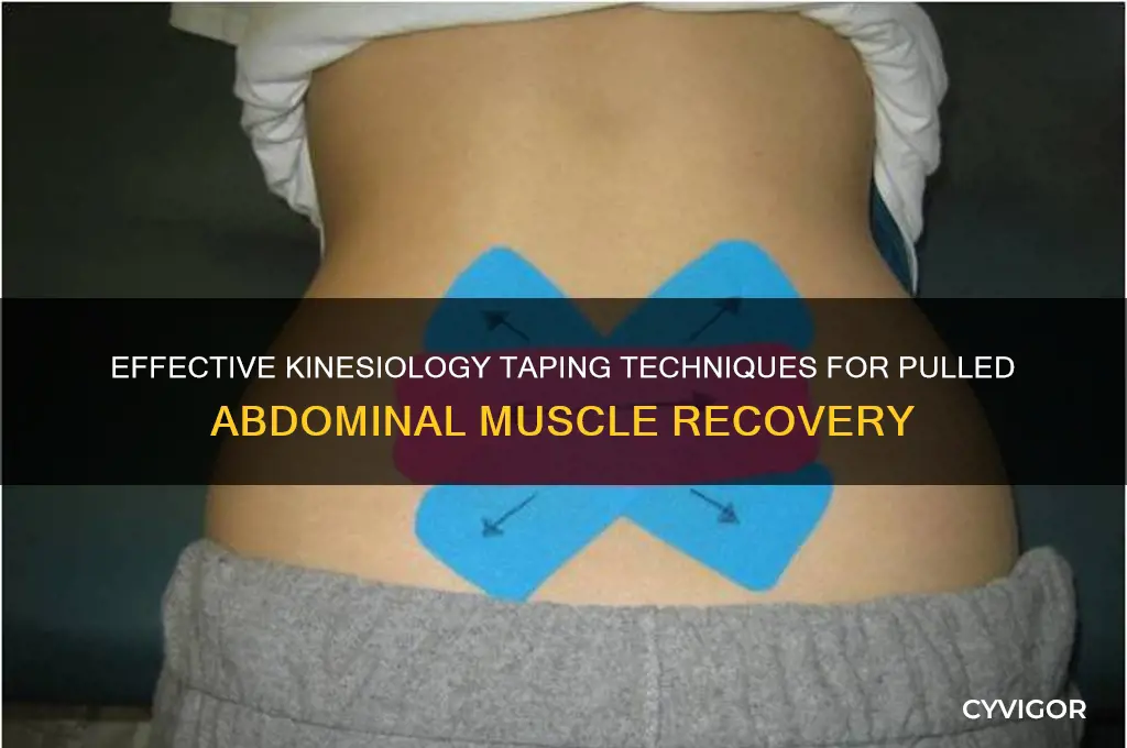 how to kt tape pulled abdominal muscles