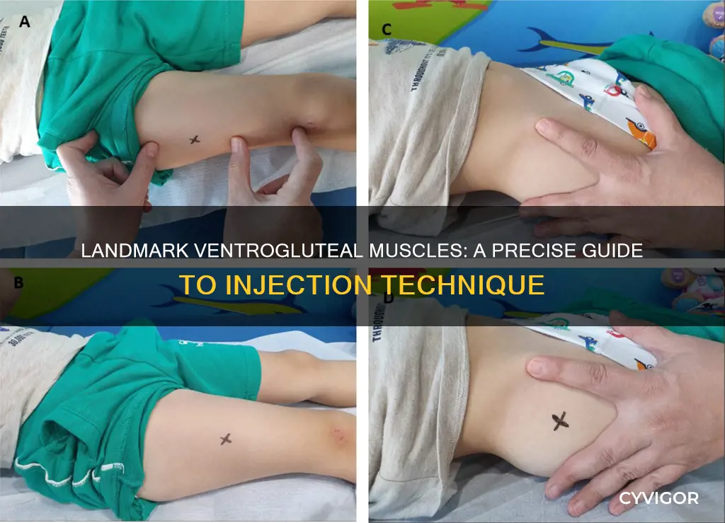 how to landmark ventrogluteal muscles