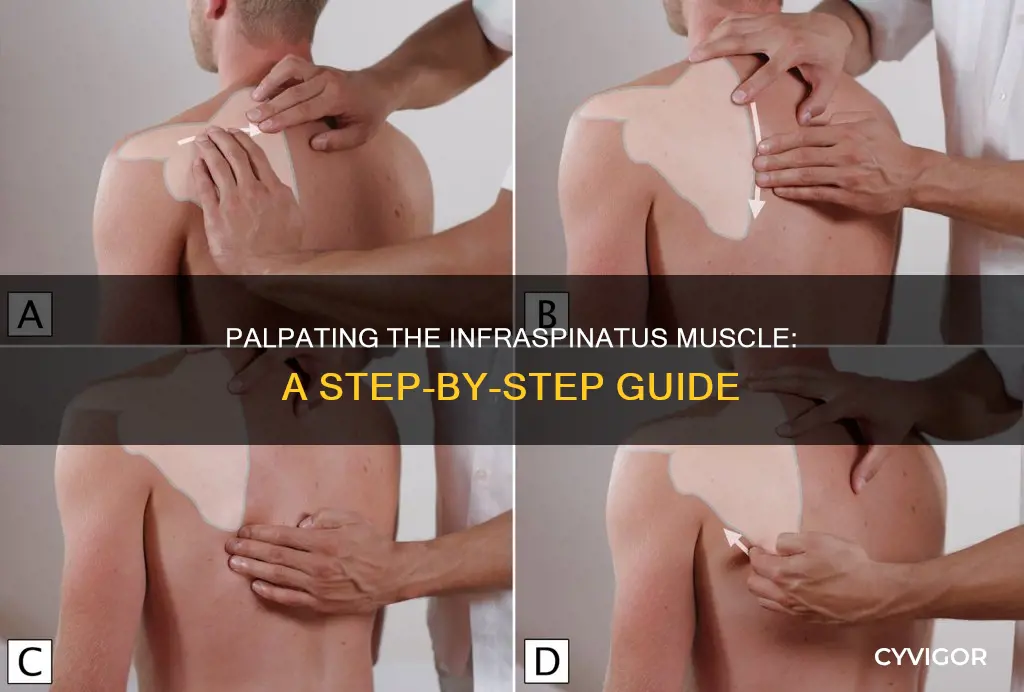 how to palpate infraspinatus muscle