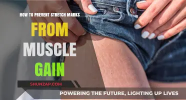 Effective Strategies to Prevent Stretch Marks During Muscle Gain