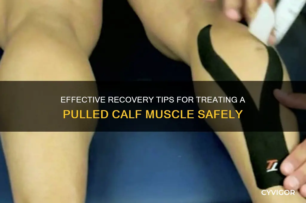 how to properly treat a pull calf muscle