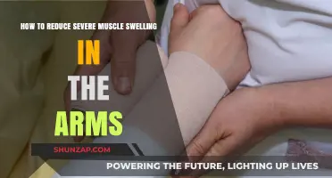 Effective Strategies to Relieve Severe Arm Muscle Swelling Fast