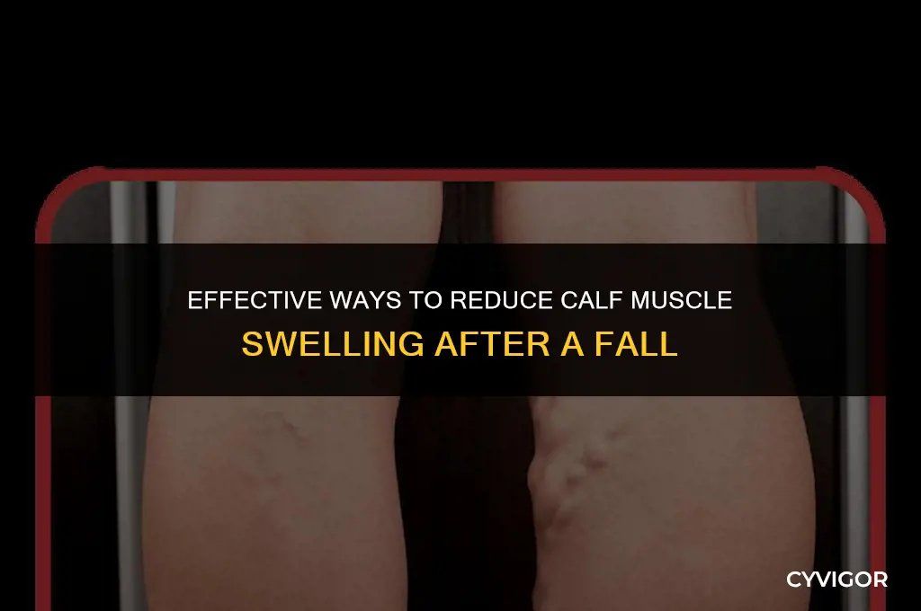 how to reduce swelling in calf muscle after falling