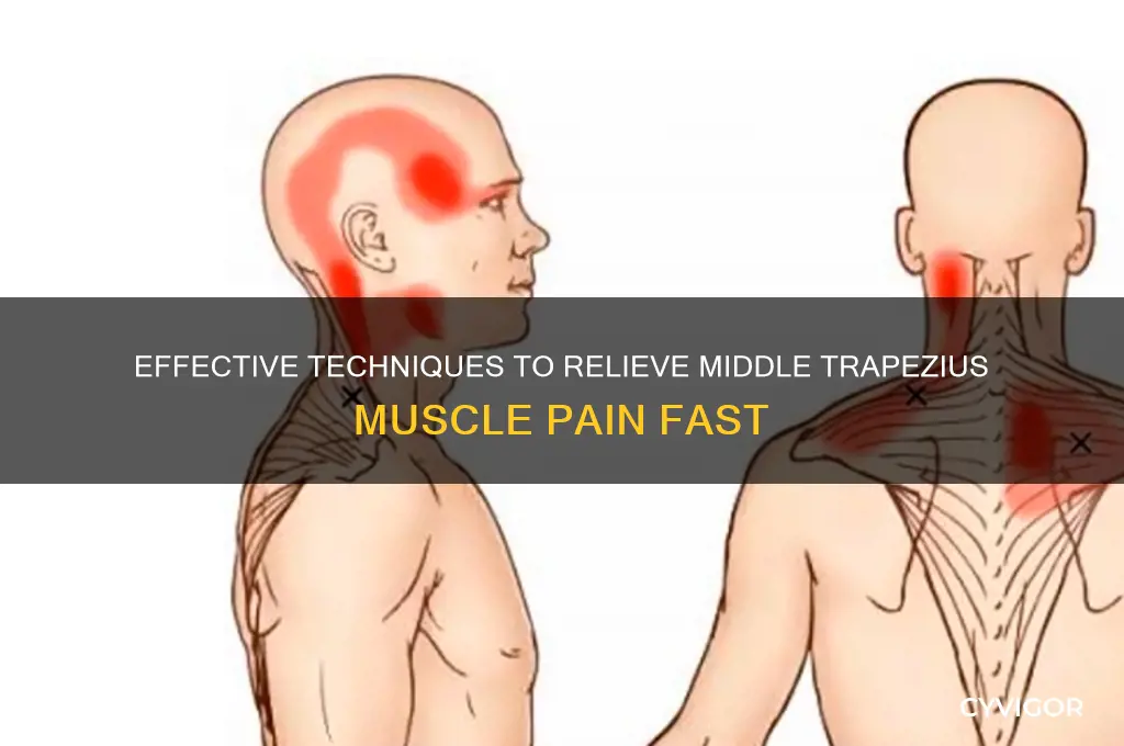 how to relieve pain in the middle trapezius muscle
