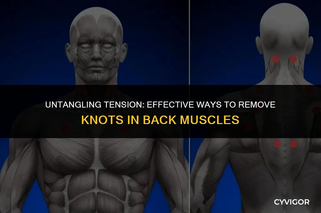 how to remove knots in back muscles