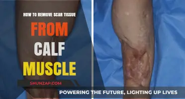 Effective Ways to Dissolve Scar Tissue in Calf Muscles
