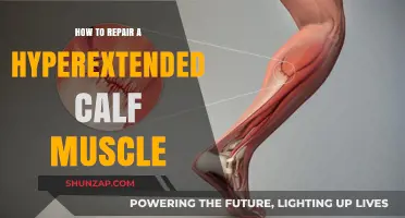 Effective Ways to Repair a Hyperextended Calf Muscle