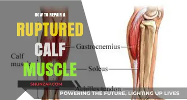 Effective Strategies for Healing a Ruptured Calf Muscle