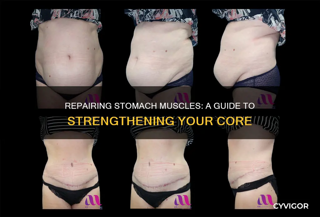 how to repair stomach muscles