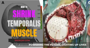 Shrinking the Temporalis Muscle: Effective Strategies and Techniques