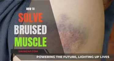 Treating Bruised Muscles: Effective Home Remedies and Tips