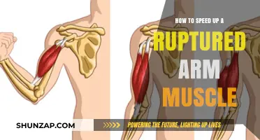 Accelerate Healing: Effective Strategies to Speed Up Ruptured Arm Muscle Recovery