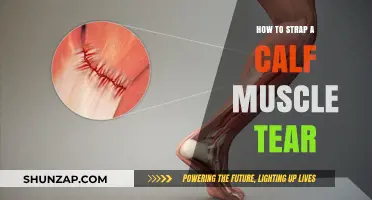 Effective Ways to Strap and Heal a Calf Muscle Tear