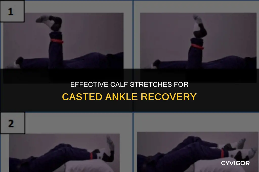 how to stretch calf muscle with ankle in cast