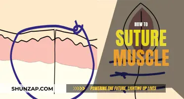 Suturing Muscles: A Step-by-Step Guide for Beginners