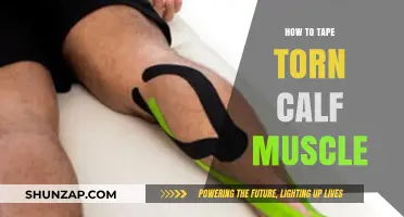 Effective Taping Techniques for a Torn Calf Muscle Injury