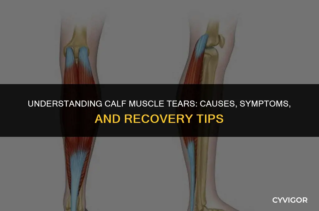 how to tear a calf muscle