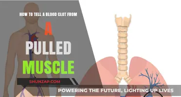 Blood Clot or Pulled Muscle: Key Symptoms and Differences Explained