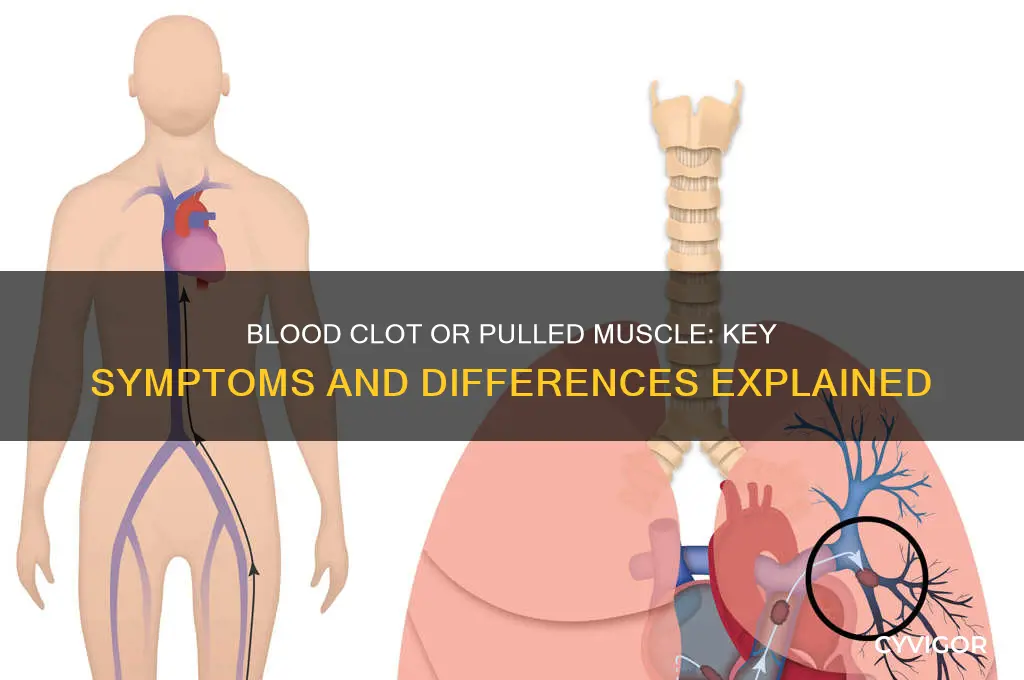 how to tell a blood clot from a pulled muscle