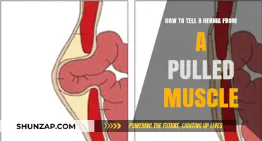 Hernia or Pulled Muscle: Key Symptoms to Identify the Difference