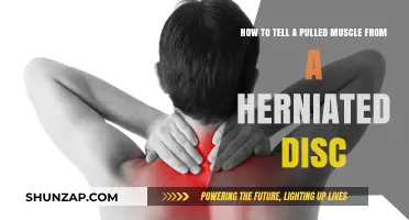 Pulled Muscle or Herniated Disc: Identifying Your Back Pain