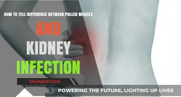 Pulled Muscle or Kidney Infection: Key Symptoms to Differentiate