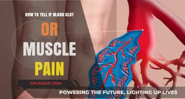 Blood Clot or Muscle Pain: Key Symptoms and Differences to Know