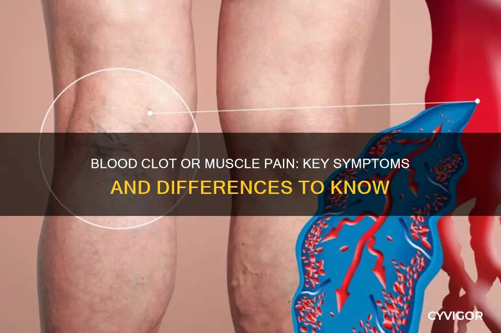 how to tell if blood clot or muscle pain