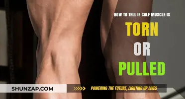 Torn or Pulled Calf Muscle: Identifying Symptoms and Seeking Relief
