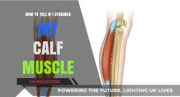 Calf Muscle Strain: Recognizing the Signs and Symptoms