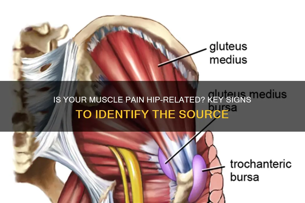 how to tell if muscle pain is from hips