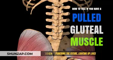 Identifying a Pulled Gluteal Muscle: Symptoms, Causes, and Relief Tips