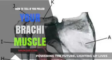 Identifying a Pulled Brachialis Muscle: Symptoms and Self-Assessment Tips