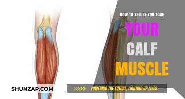 Did You Tear Your Calf Muscle? Signs and Symptoms to Look Out For