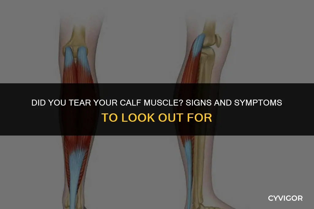 how to tell if you tore your calf muscle