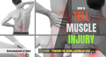 Signs of Muscle Injury: What to Look For