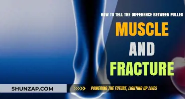 Pulled Muscle or Fracture: Key Symptoms to Identify the Injury