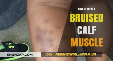 Treating a Bruised Calf Muscle: Effective Remedies and Recovery Tips
