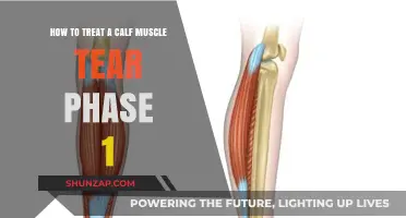 Effective Recovery: Treating Calf Muscle Tears in Phase One