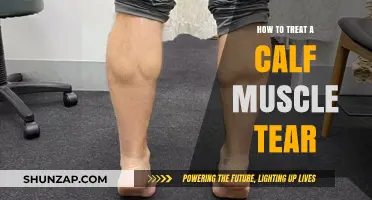 Effective Recovery Strategies for Calf Muscle Tears: A Comprehensive Guide