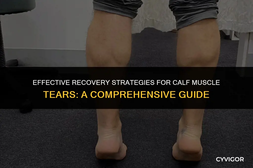 how to treat a calf muscle tear