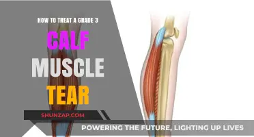 Effective Recovery Strategies for a Grade 3 Calf Muscle Tear