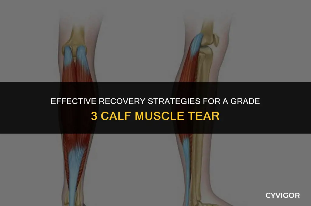 how to treat a grade 3 calf muscle tear