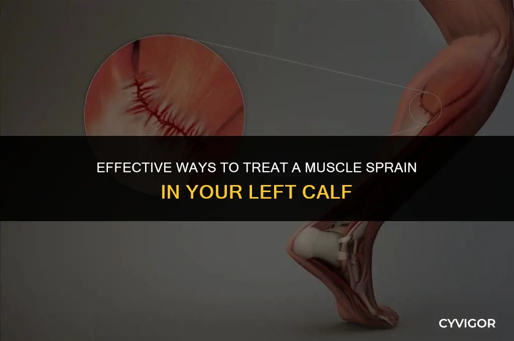 how to treat a muscle sprain in the left calf